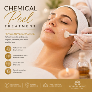 Chemical Peel